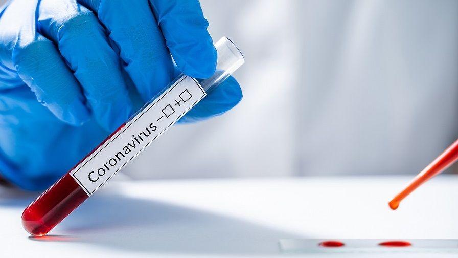 Suman ocho los casos de coronavirus CODIV-19 en la Argentina