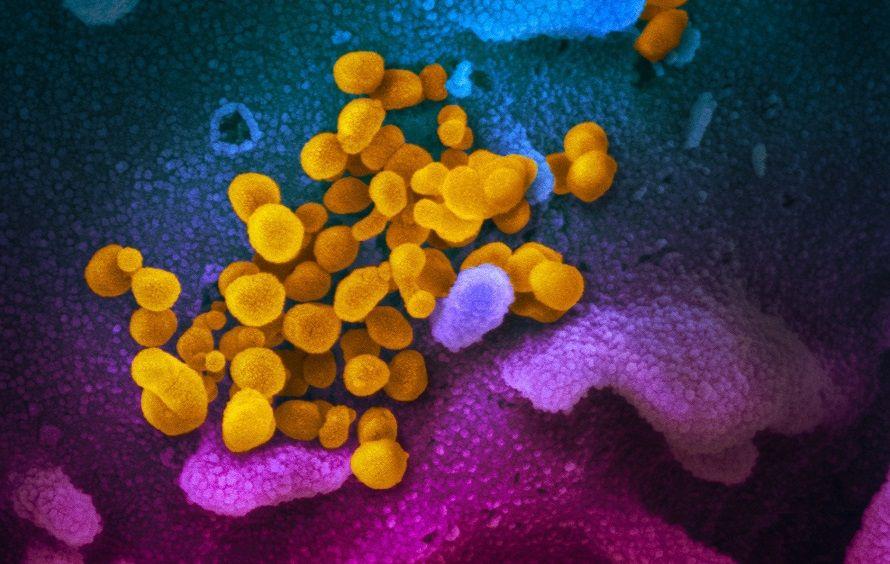 El COVID-19 permanece hasta un día en superficies de cartón