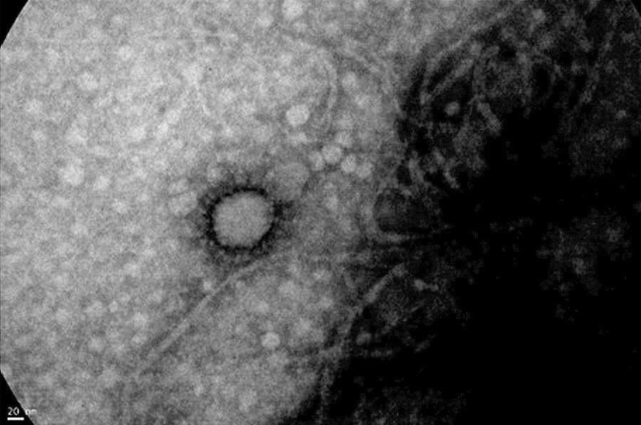 El ANLIS - Malbrán captó la primera foto del SARS-CoV-2 que circula en Argentina