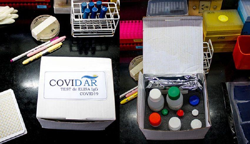 Logran desarrollar el primer test serológico del país para el COVID-19