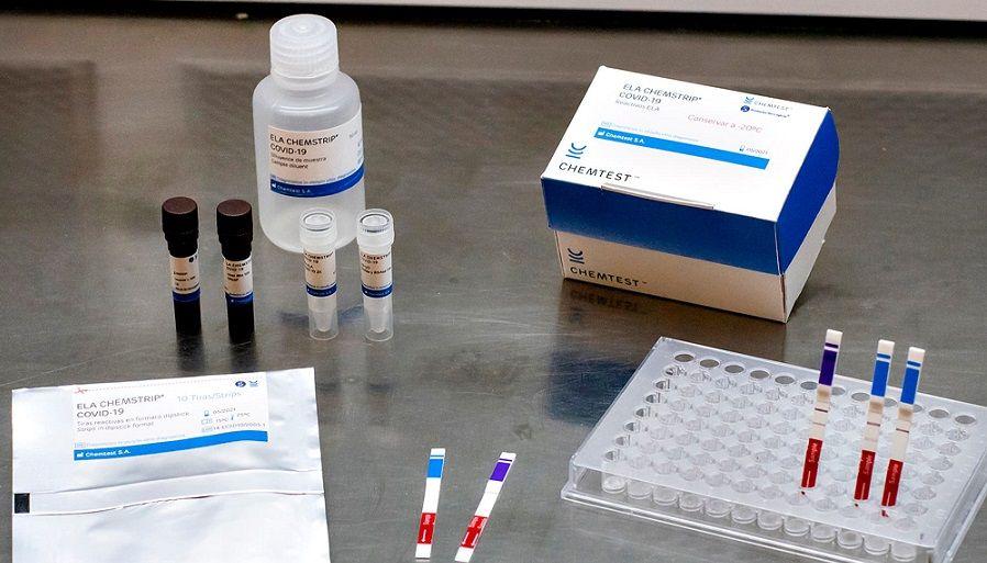 COVID-19: Desarrollan test que detecta el virus 4 veces más rápido que el PCR