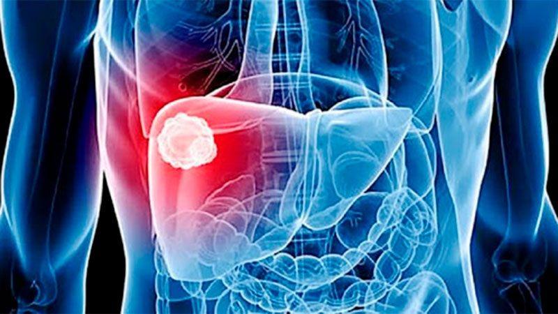 El Ministerio de Salud continúa trabajando para erradicar las hepatitis virales