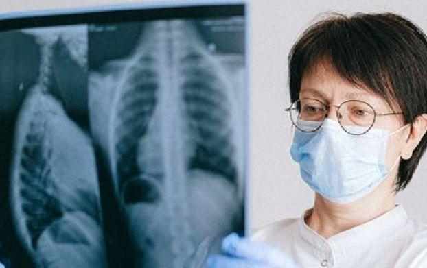 Qué es la mielitis transversa, enfermedad por la que AstraZeneca suspendió los ensayos de la vacuna