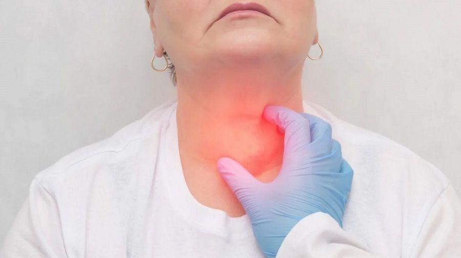 El cáncer de tiroides se hace más frecuente, aunque aseguran que no es letal