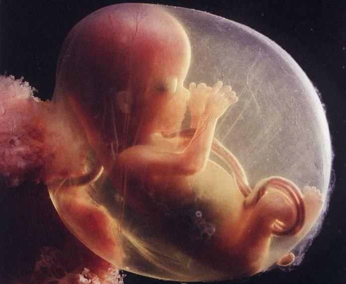 Francia: ¡aborto a los 9 meses!