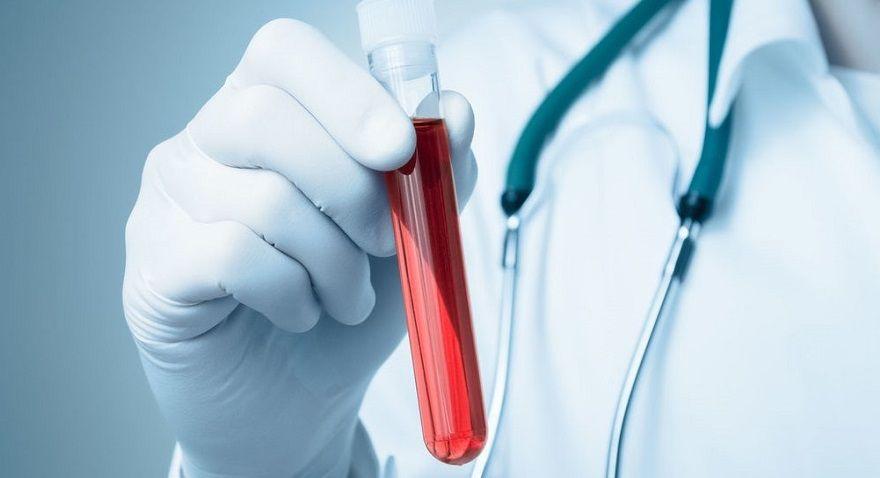 Biopsia líquida: cómo es el método no invasivo que permite diagnosticar el cáncer