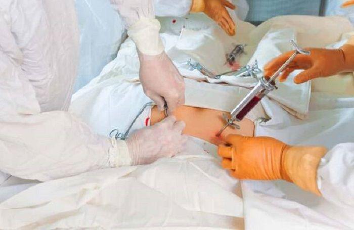 El Garrahan realizó 26 trasplantes de médula ósea en el contexto del COVID-19