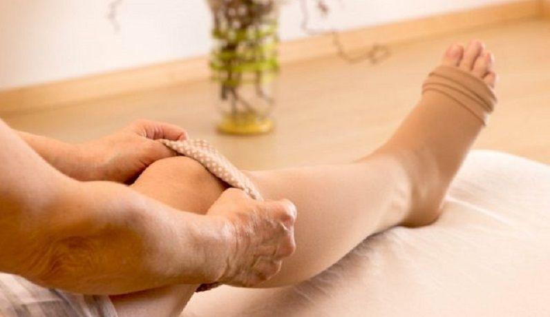 La pandemia empeoró la calidad de vida de personas con enfermedades veno-linfáticas