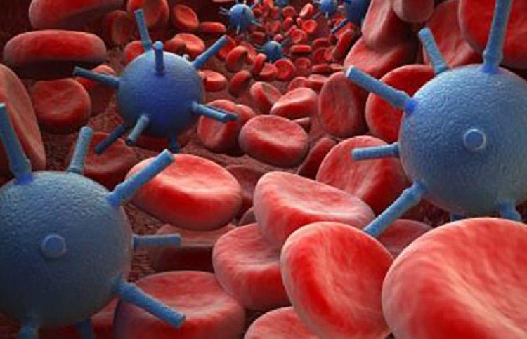 Macroglobulinemia de Waldenström: de qué se trata esta enfermedad poco frecuente