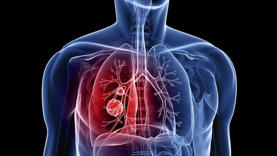 Se aprobó la reglamentación de la ley de fibrosis quística