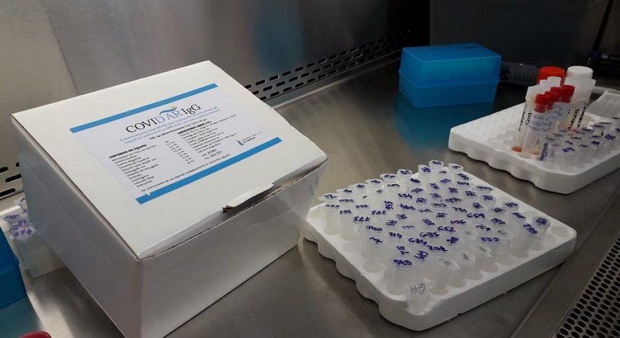 COVIDAR IgG: test serológico clave en los estudios de plasma de convalecientes
