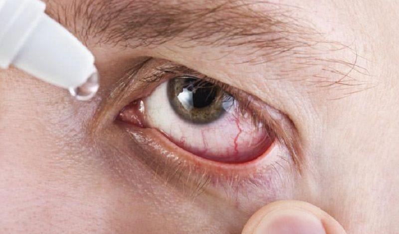 ¿Víctima del ojo seco? la regla del 20-20-20 y otras soluciones