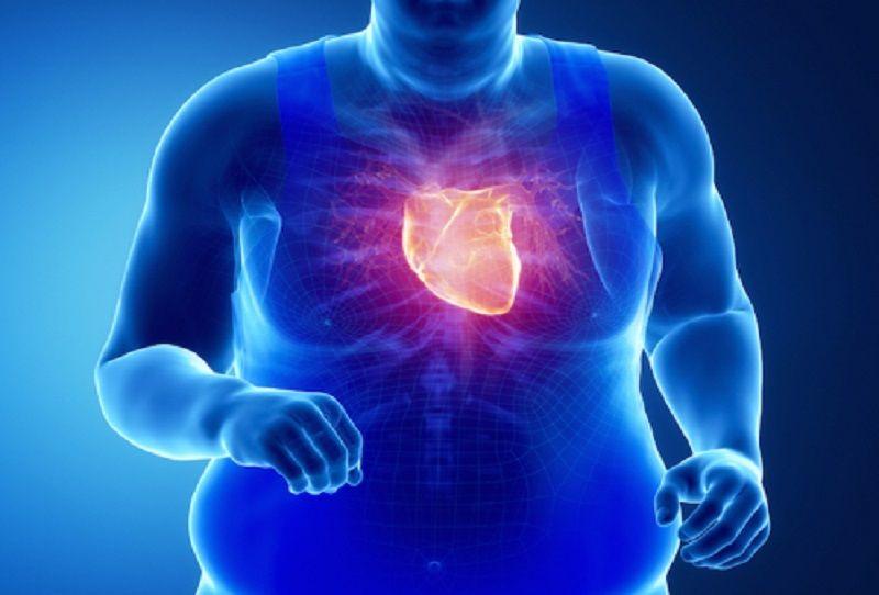 La obesidad aumenta el riesgo cardíaco incluso si se hace ejercicio