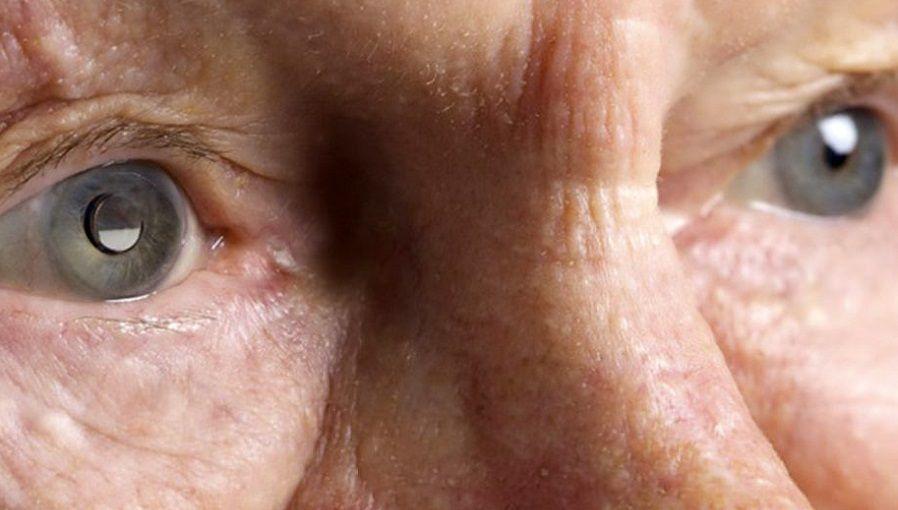 196 millones de personas sufren Degeneración Macular Relacionada con la Edad