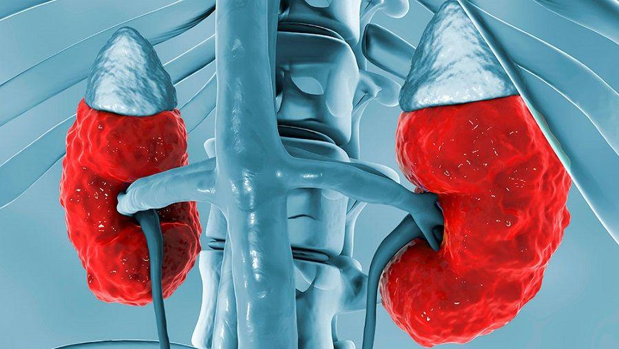 Más de 5 millones de argentinos padecen algún grado de enfermedad renal crónica