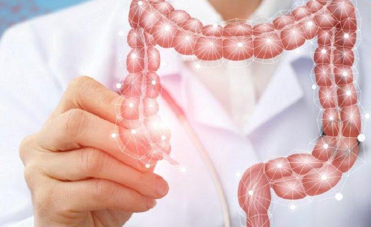 Cáncer colorrectal: Qué es, síntomas, causas, diagnóstico y tratamiento