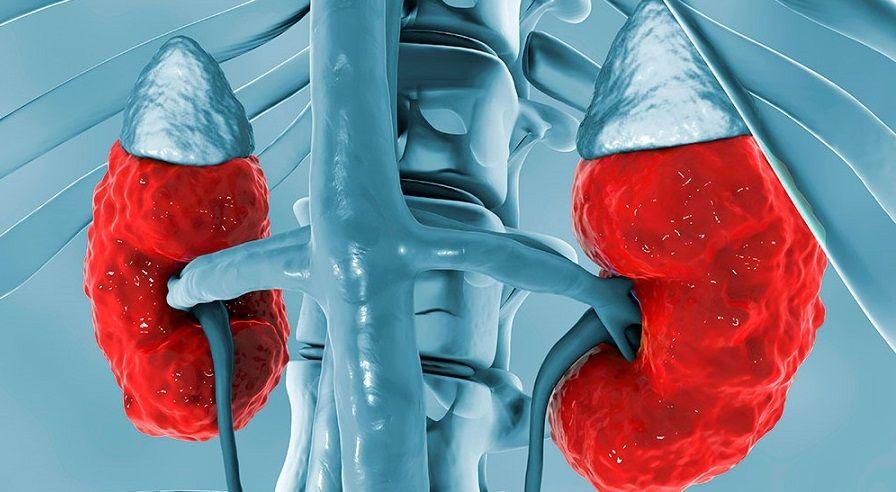 Provincia: estiman que 1.700.000 personas tienen insuficiencia renal y lo saben