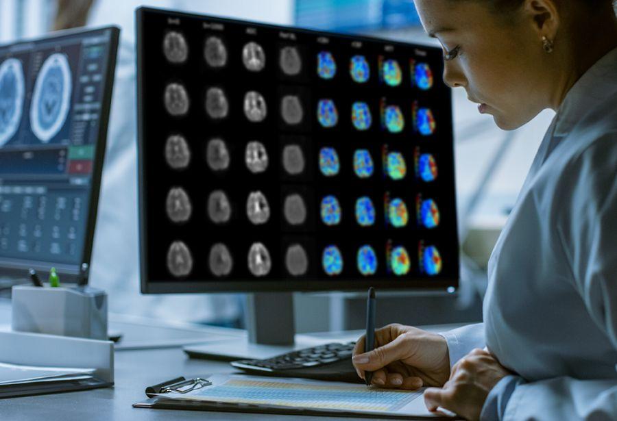 Argentina ya utiliza inteligencia artificial para el diagnóstico y tratamiento de ACV