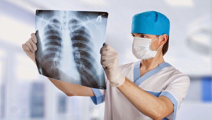 Día Mundial de la Tuberculosis: lo que debemos saber sobre esta enfermedad