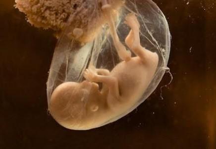 ¡¡¡Autorizan a nivel nacional el descarte de embriones congelados!!!