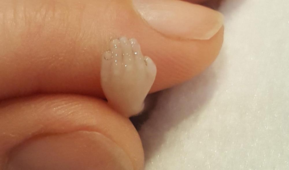 EL HIJO DE FRANCO YA HABÍA MUERTO