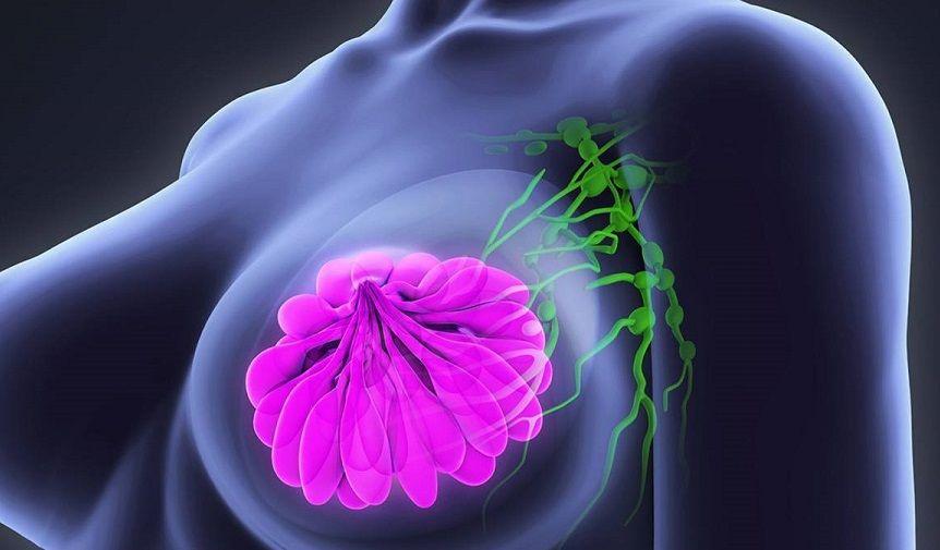Avanza la investigación para un tratamiento innovador contra el cáncer de mama