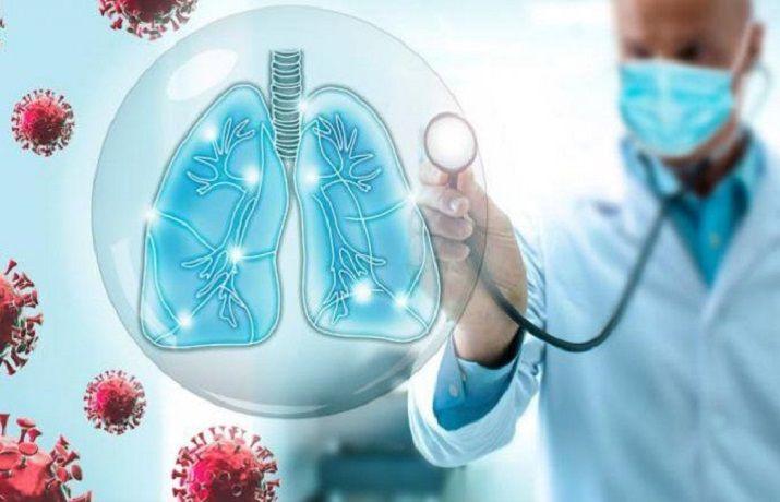 Neumonía bilateral, la enfermedad que produce más internaciones por COVID-19