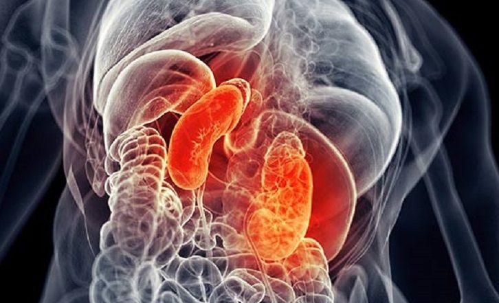 El avance que cambió el pronóstico del cáncer renal
