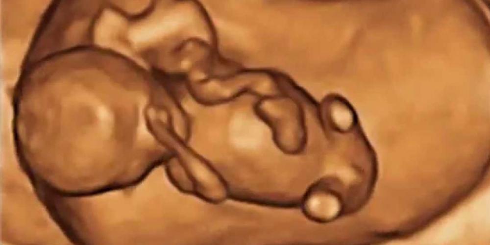 MÁS DE 18.000 NIÑOS POR NACER ELIMINADOS EN BUENOS AIRES