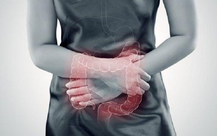 30/06 Charla abierta a la comunidad: Colon Irritable ¿De qué se trata?