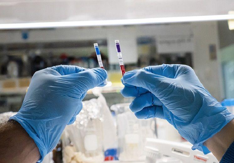 COVID-19: Hacia el primer test de antígenos 100% argentino