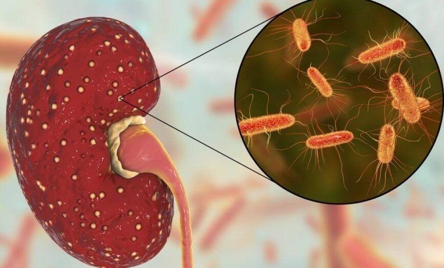Cómo prevenir el Síndrome Urémico Hemolítico (SUH)