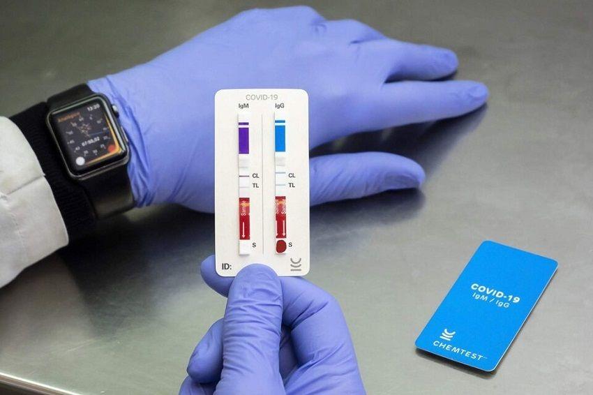 Chemtest: el nuevo test de COVID-19 creado por investigadores de la UNSAM y la UBA