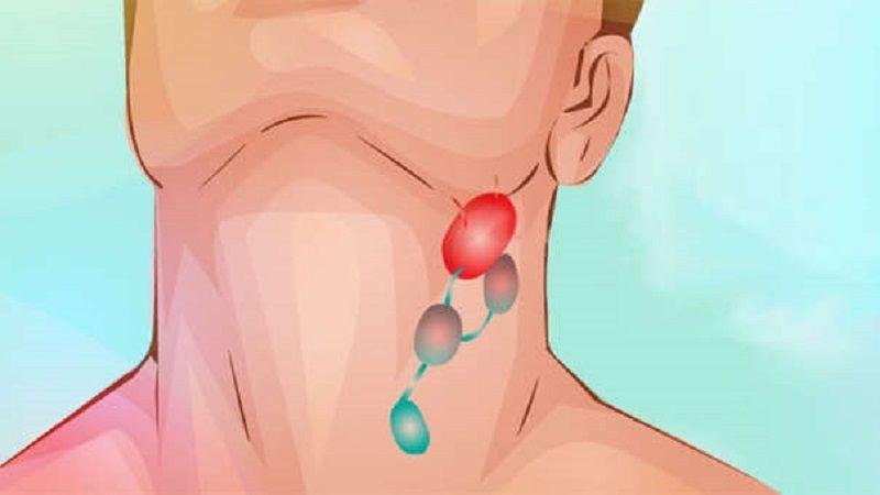 Linfomas: cada año se diagnostican 735.000 nuevos casos de esta enfermedad