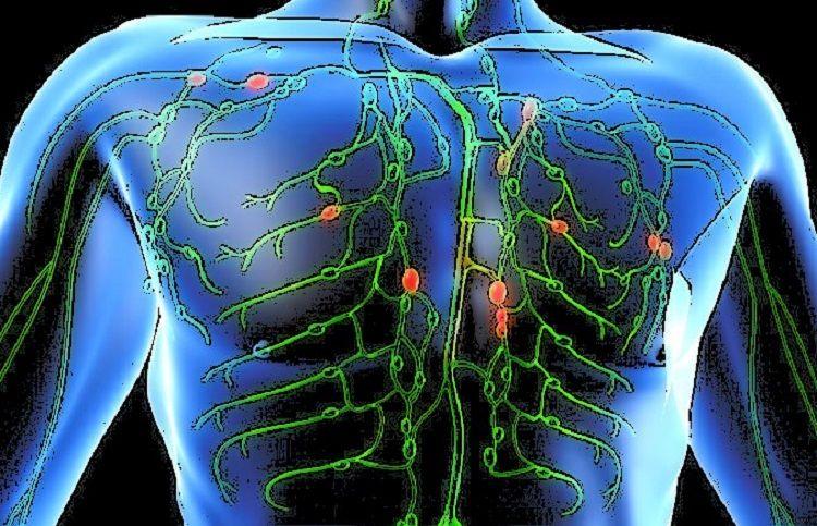 15 de septiembre: Día Mundial de Concientización del Linfoma