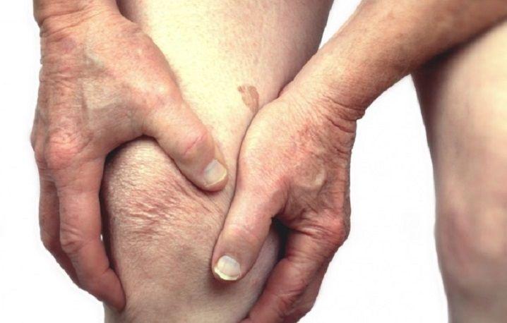 Osteoartritis: cómo calmar el dolor