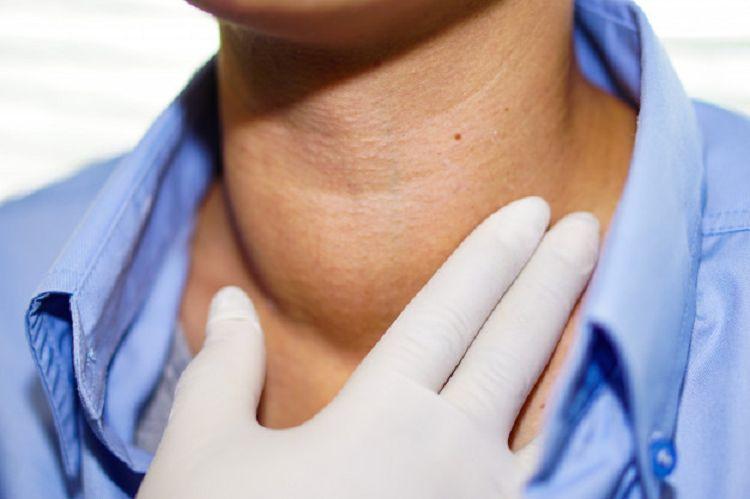 Linfoma no-Hodgkin: Uno de los cánceres más diagnosticados en Argentina