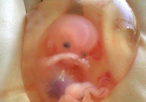 Argentina, ¿reino del revés?