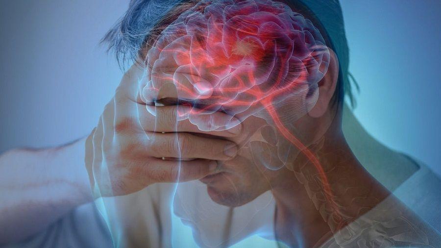 Cinco claves sobre el Accidente Cerebrovascular (ACV)