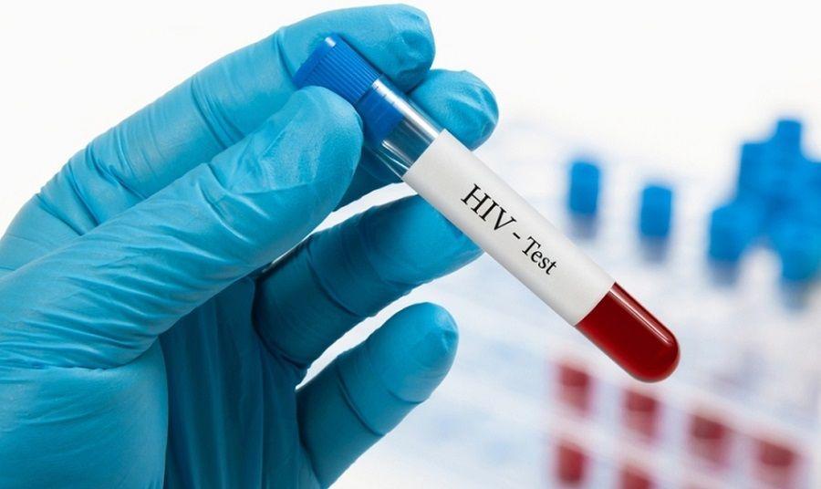 A 40 años de la aparición del SIDA: cuáles son los avances y la situación de los infectados en Argentina