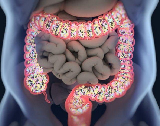 Alimentos que hay que evitar para no dañar la flora intestinal
