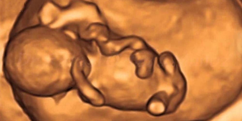 EL ESTADO MATÓ A 98 NIÑOS ARGENTINOS POR DÍA EN 2021