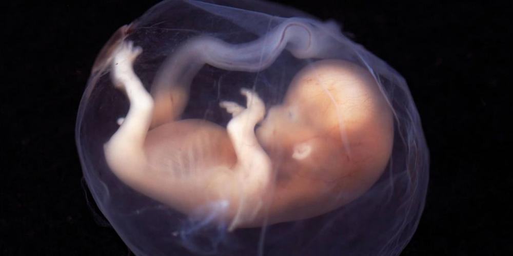 LOS ACTIVISTAS DEL GENOCIDIO CELEBRAN POR LOS MILES DE NIÑOS DESAPARECIDOS