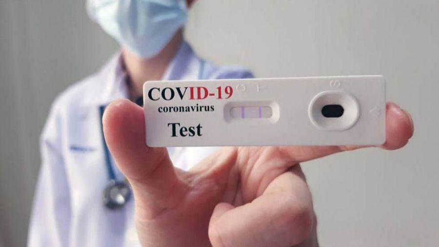 Autotest: habrá que informar el resultado a las farmacias y estas al Gobierno