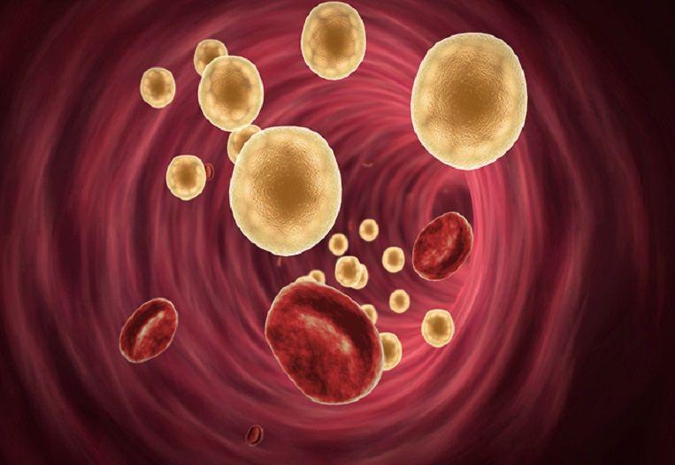 Colesterol, el enemigo cardiovascular (pero no el único)