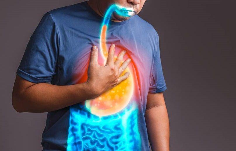 En Argentina 1 de cada 4 personas sufre de acidez