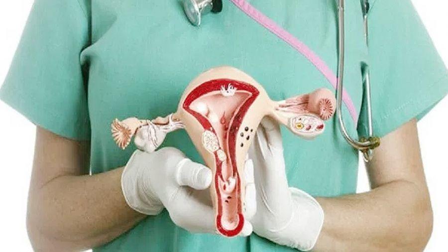 9 de cada 10 casos de cáncer uterino se podrían prevenir con control ginecológico