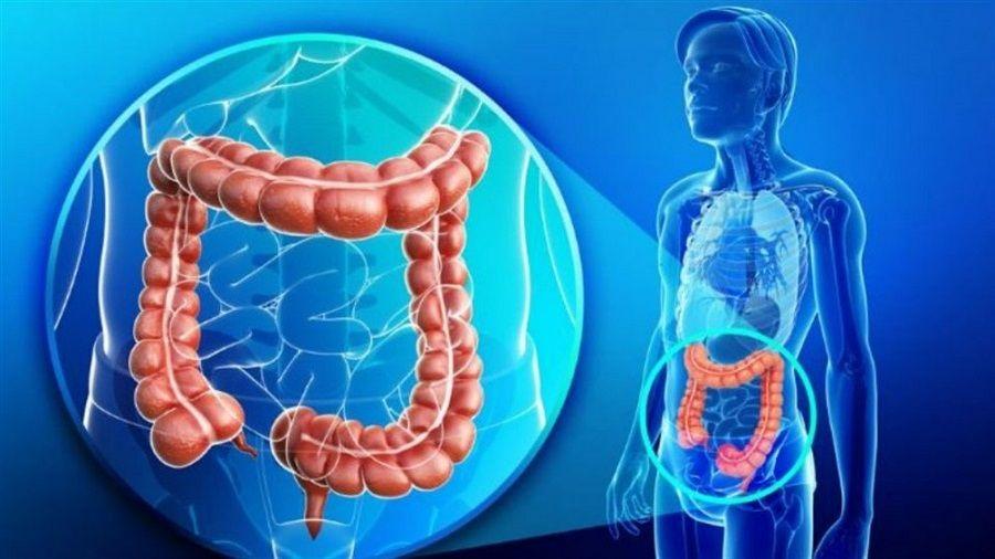 Especialistas del CONICET buscan sacarle años de ventaja al cáncer de colon