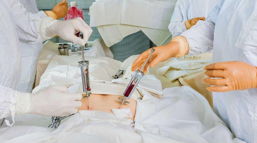 Cinco datos para conocer sobre el trasplante de médula ósea