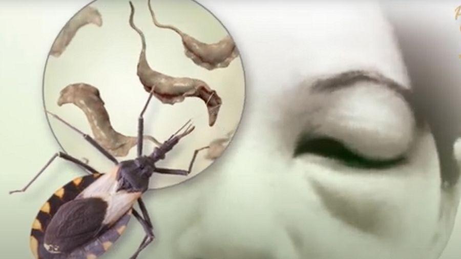 Enfermedad de Chagas: cada caso que se detecta cuenta para erradicarla